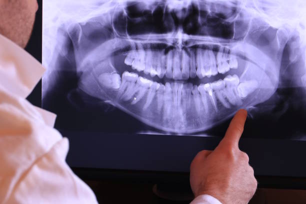 Best Emergency TMJ Treatment in Port Clinton, OH